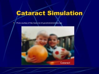 Cataract Simulation Photo courtesy of http://www.nei.nih.gov/photo/sims/index.asp 