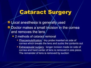 Cataract Surgery Local anesthesia is generally used Doctor makes a small incision in the cornea and removes the lens 2 methods of cataract removal Phacoemulsification :  tiny probe inserted on side of cornea which breaks the lens and sucks the contents out Extracapsular surgery :  longer incision made on side of cornea and hard center of lens is removed in one piece.  The remainder of lens is removed by suction 