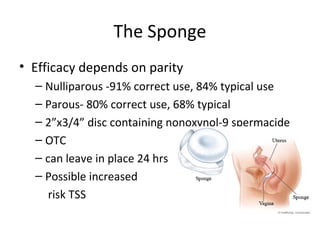 The Sponge
• Efficacy depends on parity
– Nulliparous -91% correct use, 84% typical use
– Parous- 80% correct use, 68% typical
– 2”x3/4” disc containing nonoxynol-9 spermacide
– OTC
– can leave in place 24 hrs
– Possible increased
risk TSS
 