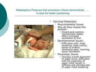 Sandifer Position Developmental Care Lecture April 2008 | PPT