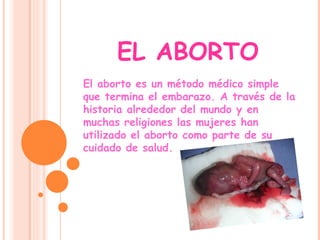 EL ABORTO El aborto es un método médico simple que termina el embarazo. A través de la historia alrededor del mundo y en muchas religiones las mujeres han utilizado el aborto como parte de su cuidado de salud.  