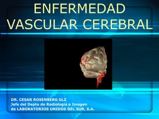 ENFERMEDAD VASCULAR CEREBRAL DR. CESAR ROSENBERG GLZ Jefe del Depto de Radiología e Imagen de LABORATORIOS UNIDOS DEL SUR, S.A. 