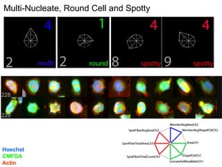 228 229 Multi-Nucleate, Round Cell and Spotty Hoechst CMFDA Actin 