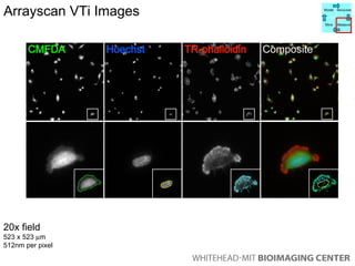 Arrayscan VTi Images 20x field   523 x 523   m  512nm per pixel Model Manipulate Mine Measure 