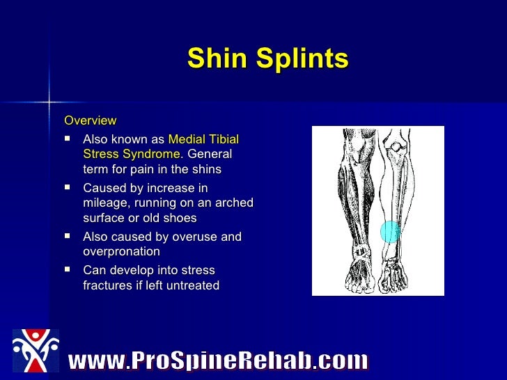 Five Most Common Running Injuries