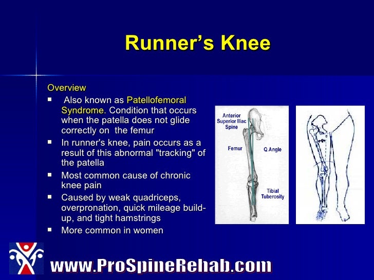 five most common running injuries tracking running mileage