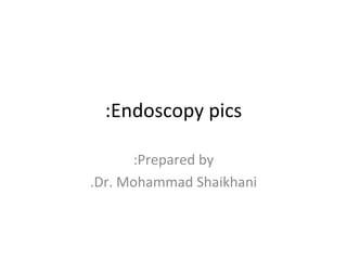 Endoscopy pics: Prepared by: Dr. Mohammad Shaikhani. 