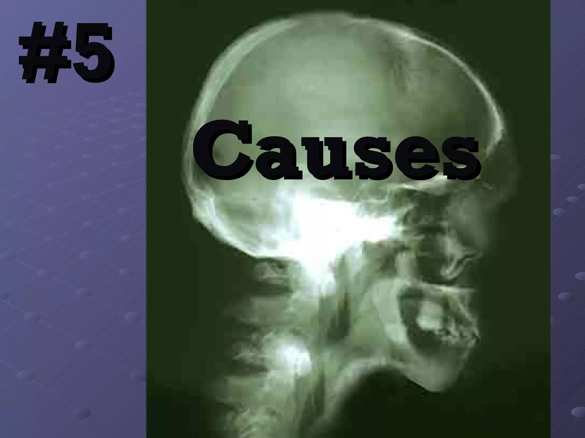 #5     Causes 