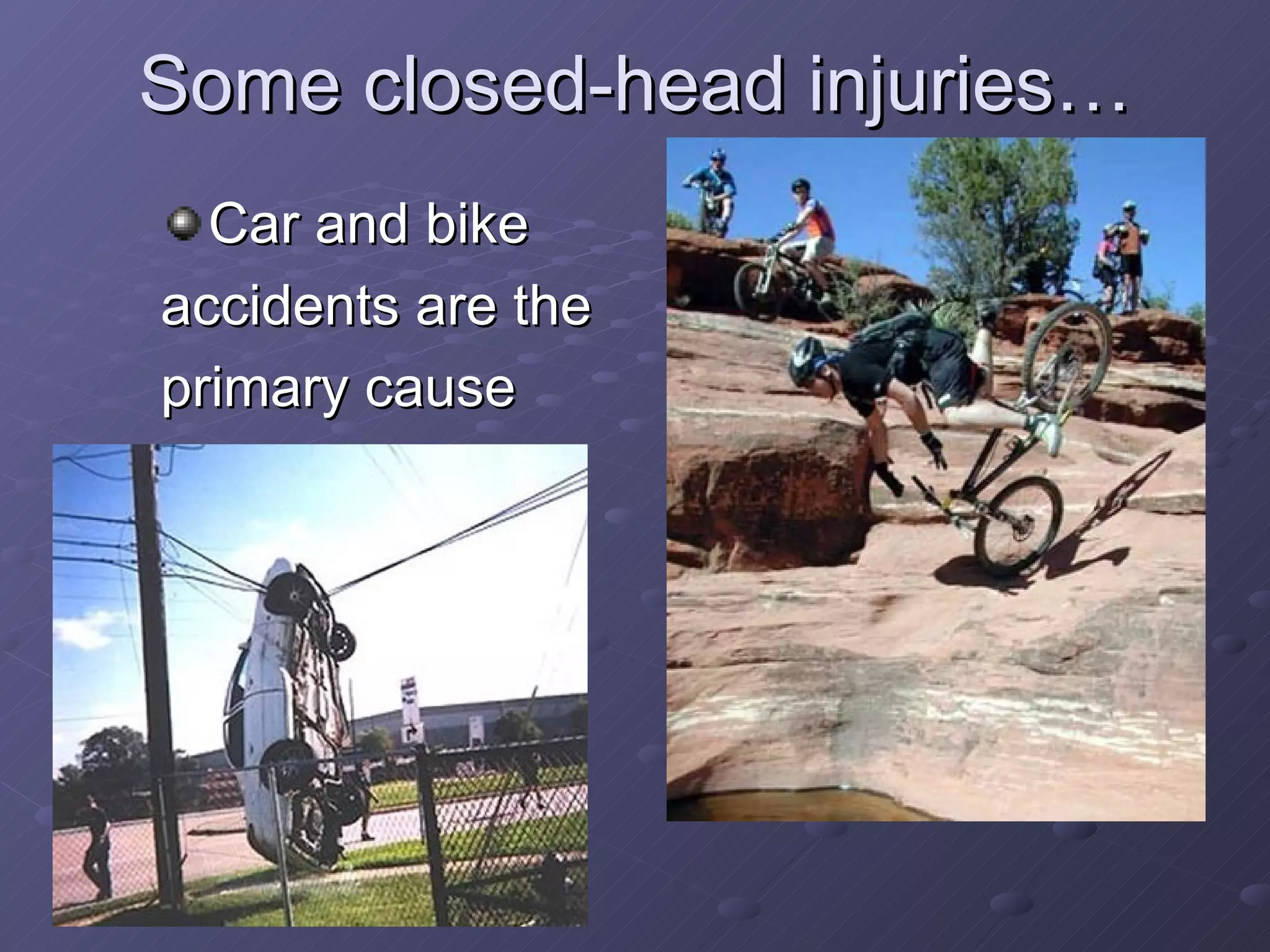 Some closed-head injuries… Car and bike  accidents are the  primary cause 