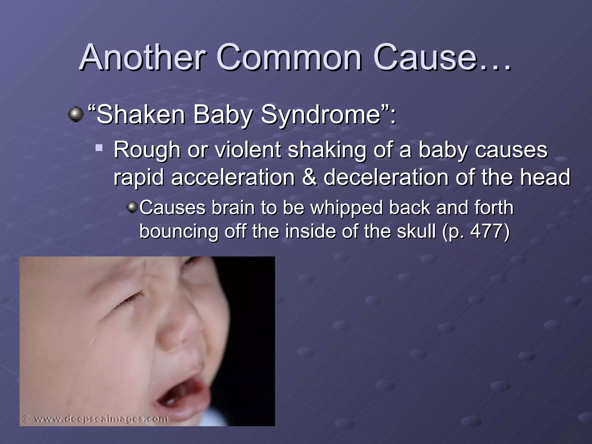 Another Common Cause… “Shaken Baby Syndrome”: Rough or violent shaking of a baby causes rapid acceleration & deceleration of the head Causes brain to be whipped back and forth bouncing off the inside of the skull (p. 477) 