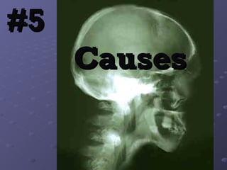 #5     Causes 