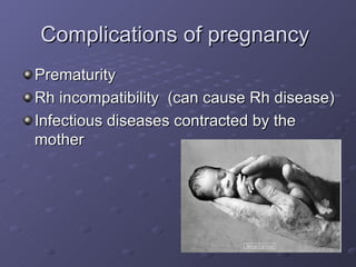 Complications of pregnancy  Prematurity Rh incompatibility  (can cause Rh disease) Infectious diseases contracted by the mother 