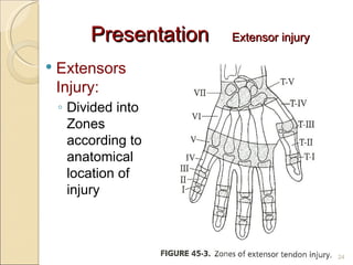 Hand Trauma | PPT