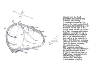 Viewed from the RAO projection, the anterior and posterior descending coronaries course from the base of the heart on the left of the image, towards the apex of the heart on the right of the image, while the left circumflex and right coronary arteries are captured running from top to bottom of the image, more or less in parallel with the loop they define at the base of the heart.  (LM=left main coronary; LAD=left anterior descending; LADD=diagonal branches; LCx=left circumflex; CM=marginal branches; LPL=left posterolateral branch; RCA=right coronary artery; RVB=right ventricular branch; AcM=acute marginal branch; RPDA=right posterior descending; RPL=right posterolateral branch.)  