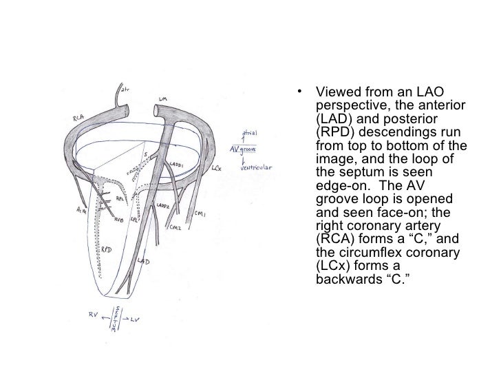 Heldman Coronary Anatomy Diagrams
