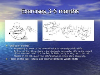 Exercises 3-6 months <ul><li>Sitting on the ball </li></ul><ul><ul><li>Progressing to lower on the trunk with side to side...