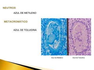 NEUTROS
AZUL DE METILENO
METACROMÁTICO
AZUL DE TOLUIDINA
Azul de Metileno Azul de Toluidina
 