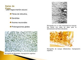 Sales de
Plata
color negro-marrón oscuro:
Fibras de reticulina,
Dendritas
Axones neuronales
Prolongaciones gliales
Micrografía de un corte transversal de músculo
liso teñido con sales de plata para la
demostración de fibras reticulares.
Micrografía de Mesenterio. Impregnación argéntica.
Micrografía de Lengua (Mastocitos). Impregnación
argéntica.
 