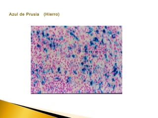 Azul de Prusia (Hierro)
 