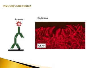 INMUNOFLURECESCIA
Rodamina
GFAP
 