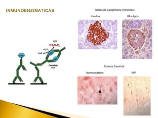 INMUNOENZIMATICAS Islotes de Langerhans (Páncreas)
Insulina Glucágon
Corteza Cerebral
Isomastotatina VIP
 