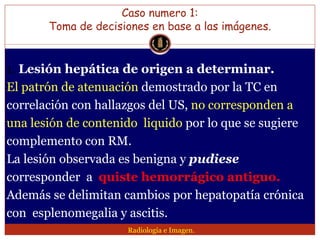 Lesion focal hepatica