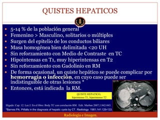 Lesion focal hepatica