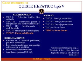 Lesion focal hepatica