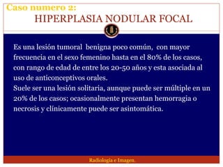 Lesion focal hepatica