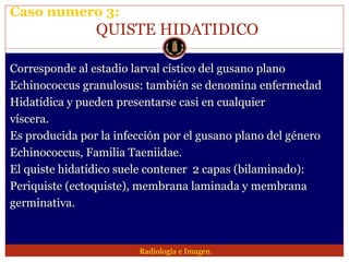 Lesion focal hepatica