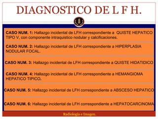 Lesion focal hepatica