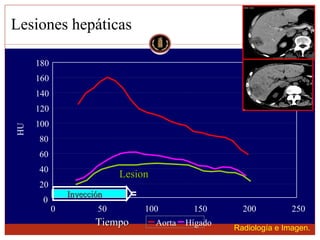 Lesion focal hepatica