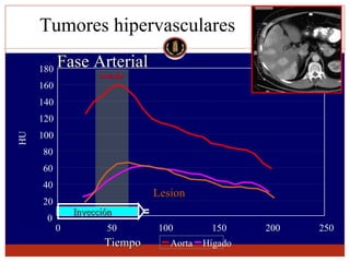 Lesion focal hepatica