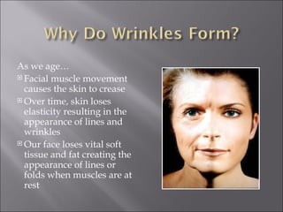 As we age… Facial muscle movement causes the skin to crease Over time, skin loses elasticity resulting in the appearance of lines and wrinkles Our face loses vital soft tissue and fat creating the appearance of lines or folds when muscles are at rest 