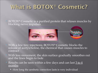 BOTOX ®  Cosmetic is a purified protein that relaxes muscles by blocking nerve impulses With a few tiny injections, BOTOX ®  Cosmetic blocks the release of acetylcholine, the chemical that causes muscles to contract With less movement, the skin surface gradually smoothes out and the lines begin to fade Results can be seen within a few days and can last  3 to 4 months How long the aesthetic correction lasts is very individual 