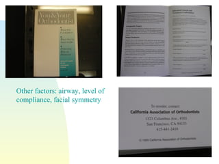 Other factors: airway, level of compliance, facial symmetry 