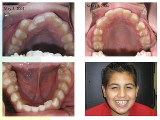 May 3, 2004 Sept 10, 2004 