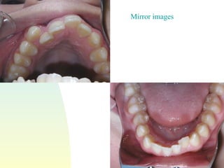 Mirror images 