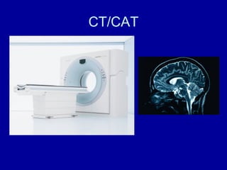 CT/CAT 