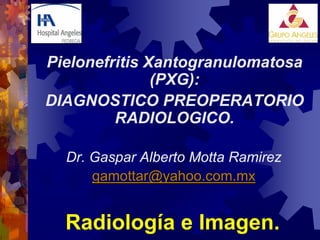 Pielonefritis Xantogranulomatosa
               (PXG):
DIAGNOSTICO PREOPERATORIO
         RADIOLOGICO.

  Dr. Gaspar Alberto Motta Ramirez
      gamottar@yahoo.com.mx


  Radiología e Imagen.
 