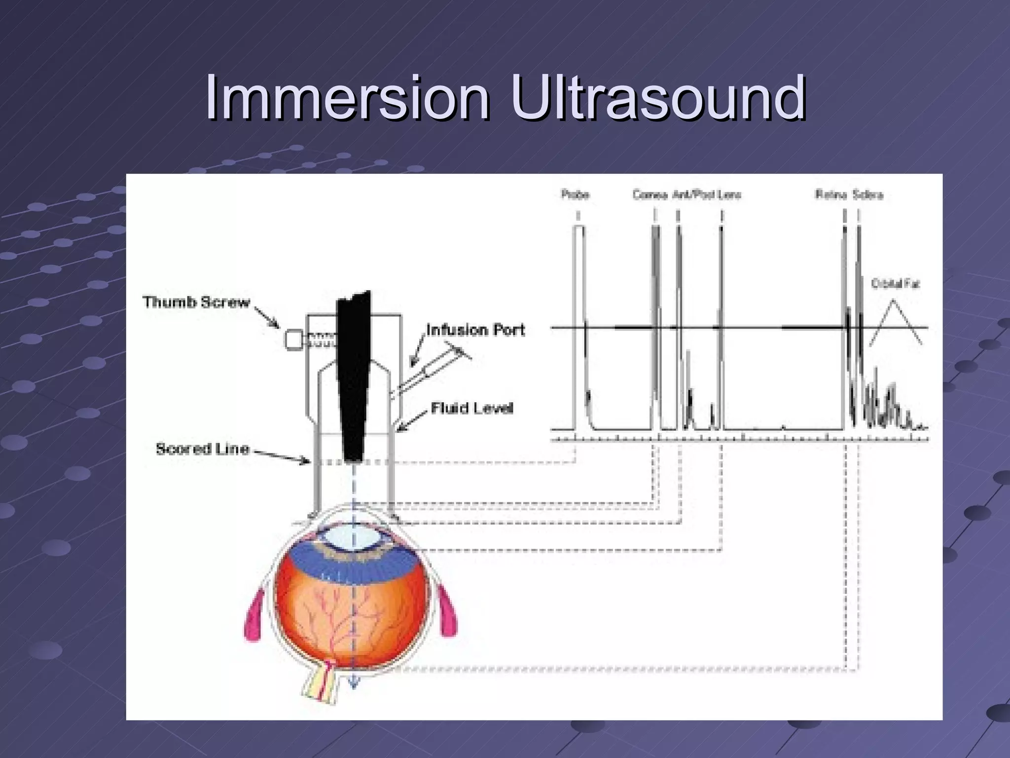 Immersion Ultrasound 