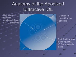 Pre And Postoperative Care Of The Modern Cataract Patient | PPT