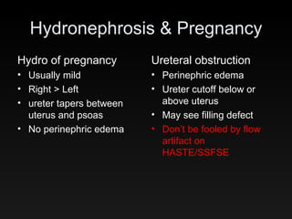Hydronephrosis & Pregnancy Hydro of pregnancy Usually mild Right > Left ureter tapers between uterus and psoas No perinephric edema Ureteral obstruction Perinephric edema Ureter cutoff below or above uterus May see filling defect Don’t be fooled by flow artifact on HASTE/SSFSE 