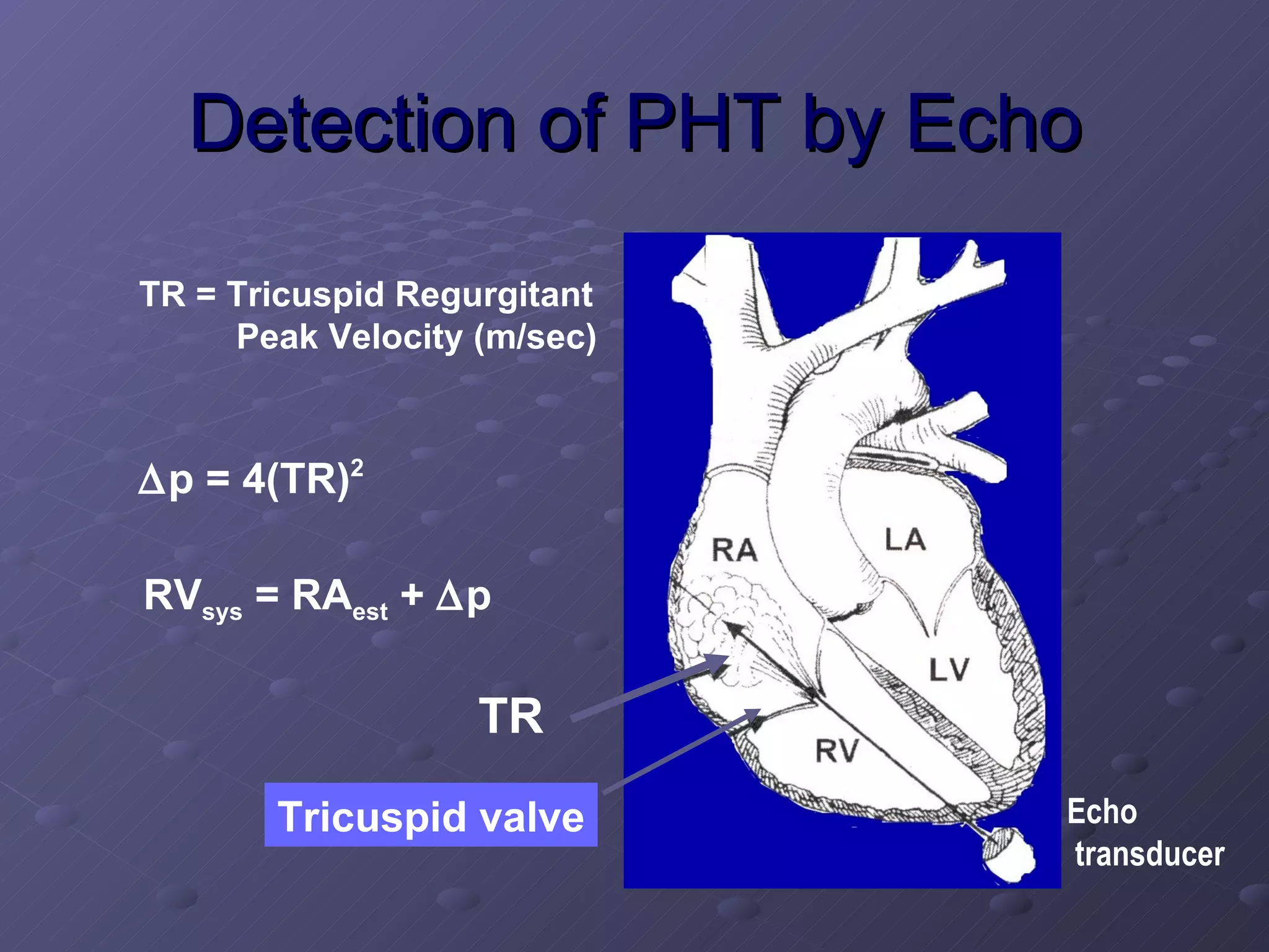 Pulmonary Hypertension 1 | PPT