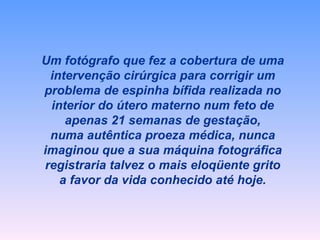 Um fotógrafo que fez a cobertura de uma intervenção cirúrgica para corrigir um problema de espinha bífida realizada no interior do útero materno num feto de apenas 21 semanas de gestação, numa autêntica proeza médica, nunca imaginou que a sua máquina fotográfica registraria talvez o mais eloqüente grito a favor da vida conhecido até hoje. 