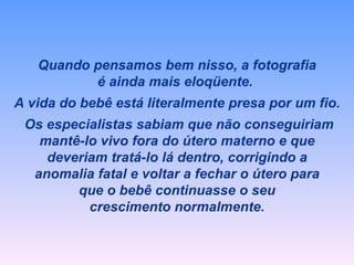 Quando pensamos bem nisso, a fotografia é ainda mais eloqüente.  A vida do bebê está literalmente presa por um fio. Os especialistas sabiam que não conseguiriam mantê-lo vivo fora do útero materno e que deveriam tratá-lo lá dentro, corrigindo a anomalia fatal e voltar a fechar o útero para que o bebê continuasse o seu crescimento normalmente. 
