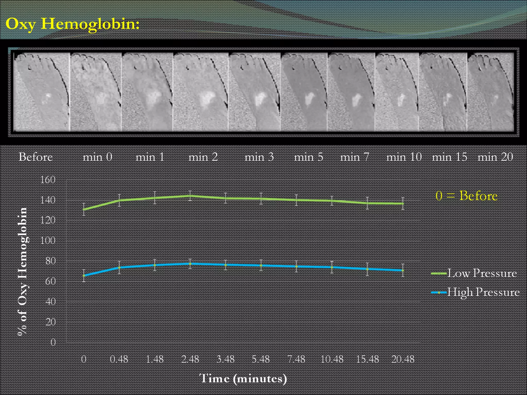 Oxy Hemoglobin:  Before  min 0  min 1  min 2  min 3  min 5  min 7  min 10  min 15  min 20 