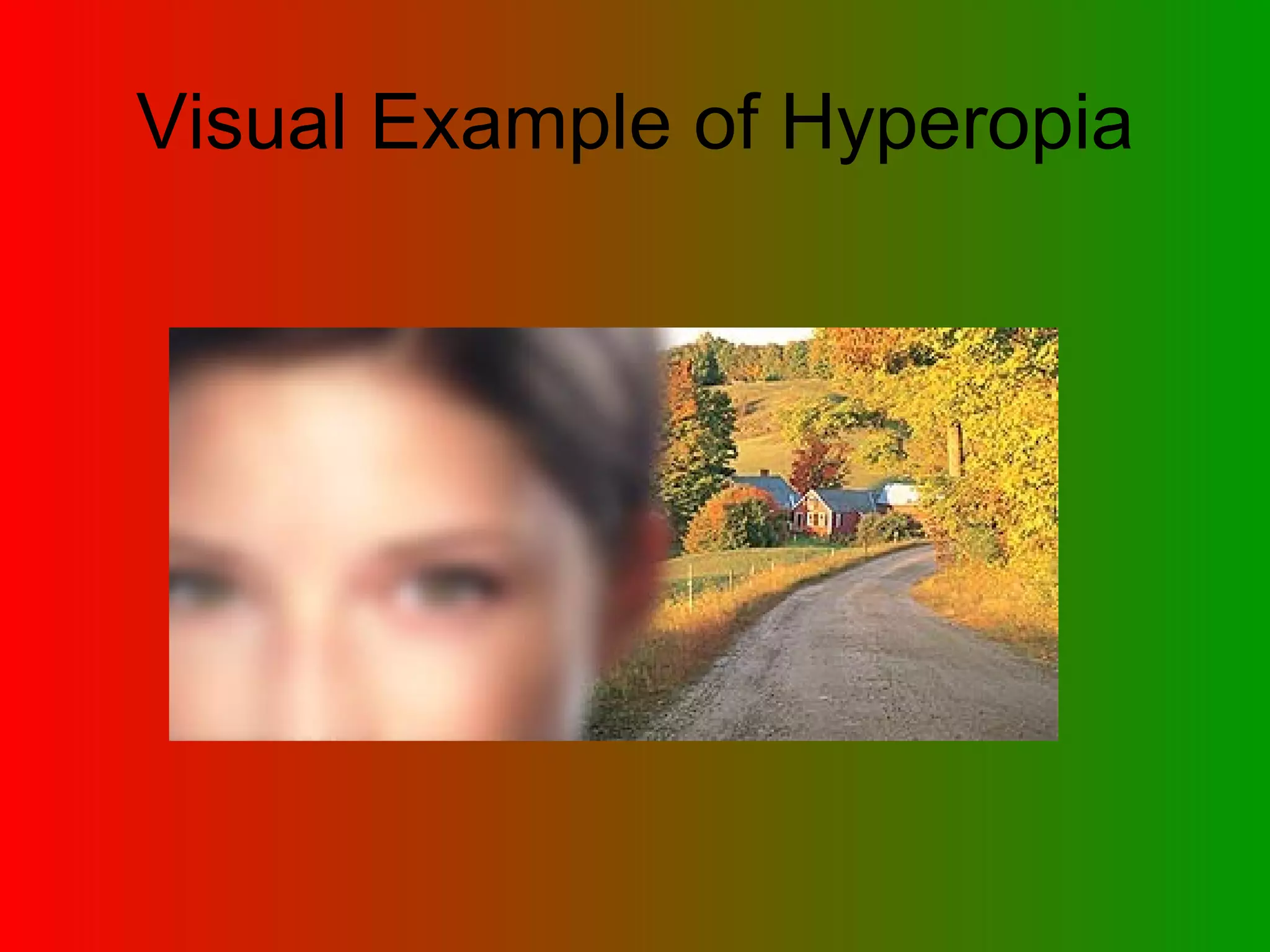 Visual Example of Hyperopia 
