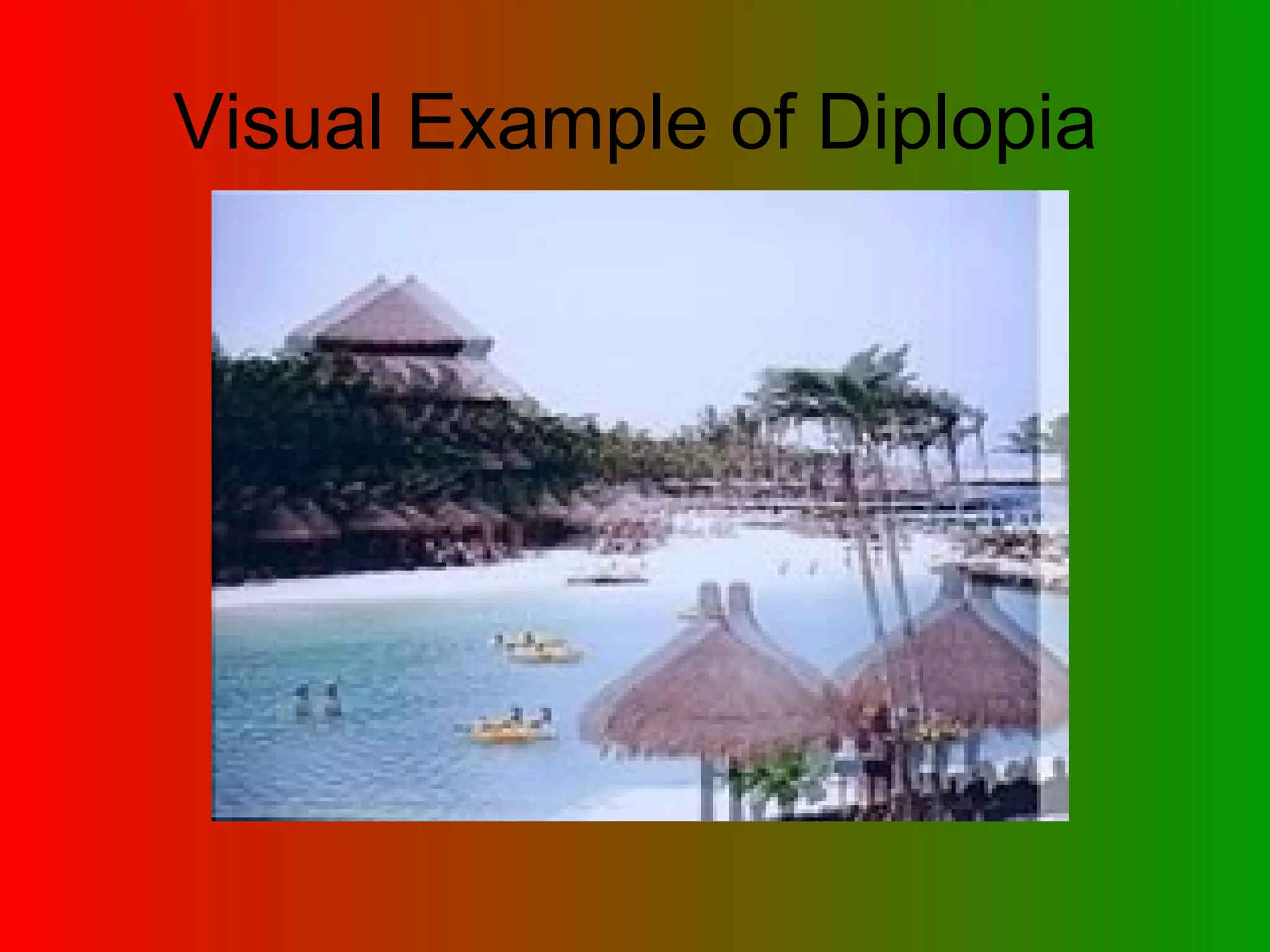 Visual Example of Diplopia 