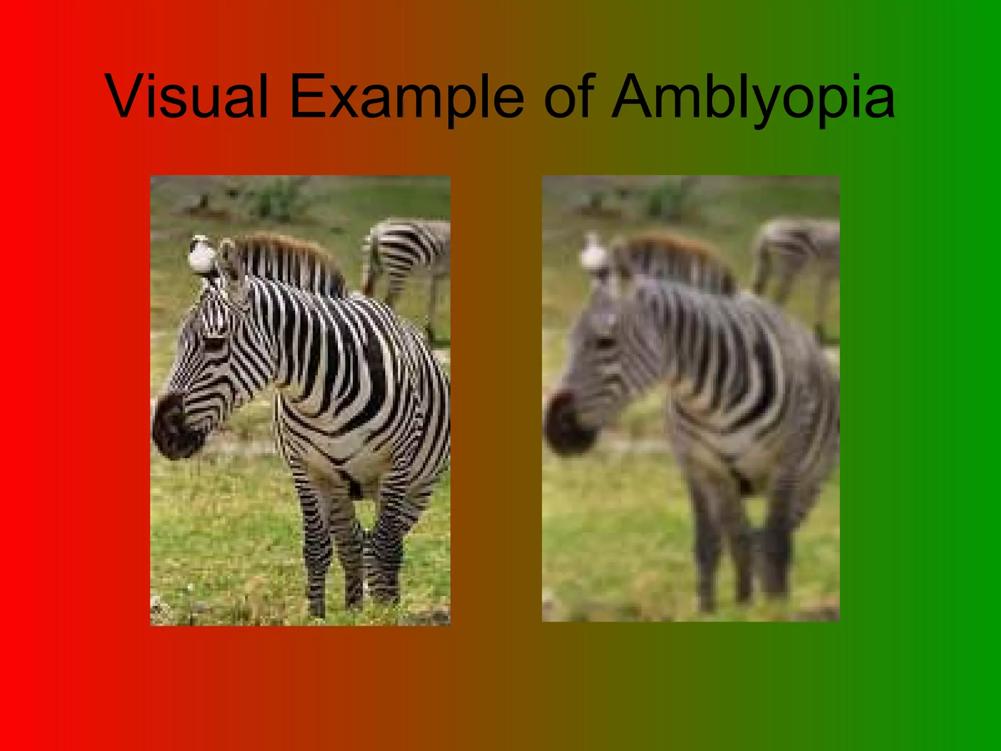 Visual Example of Amblyopia 